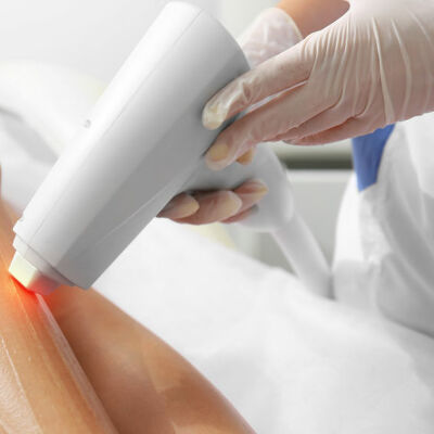 .LASERBEHANDLUNGEN (ERBIUM + KTP)