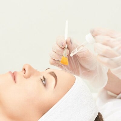 PEELINGS / MICRONEEDLING